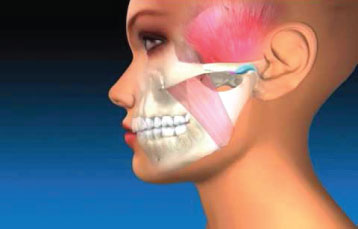 TMJ Explanation & Therapy